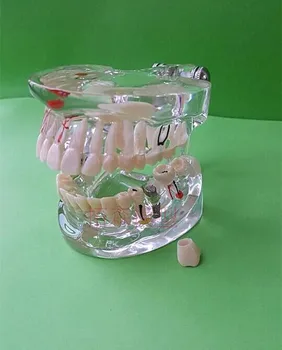 Стоматологични материали Модел на патология на устната кухина при възрастни безплатна доставка